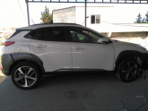 HYUNDAİ KONA ABS BEYNİ,ABS,OKUYUCU SENSÖR